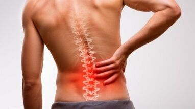 Anzeichen und Symptome einer Osteochondose der Lumbalsäule