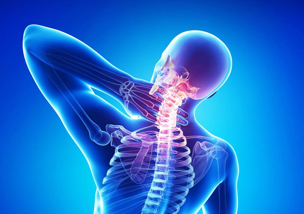 Osteochondrose des Halses