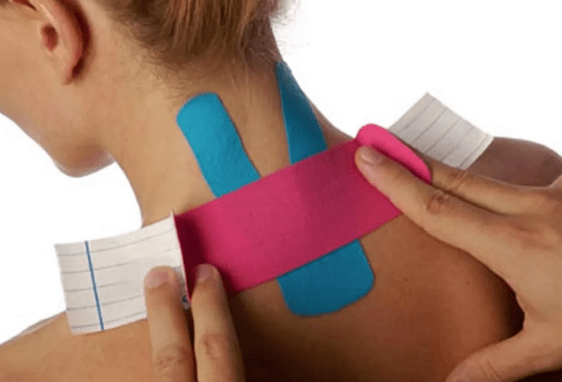 Taping gegen Nackenschmerzen