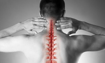 Wie sich eine Osteochondrose der Halswirbelsäule äußert