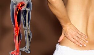 Eigenschaften von Rückenschmerzen